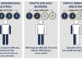 Understanding Cerebral Palsy in Children: Symptoms and Care